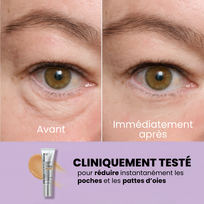 EyeLift - Gel raffermissant anti-âge